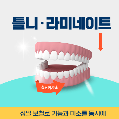 포천치과 포천시 치과 틀니 라미네이트