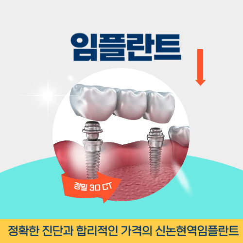 포천치과 포천시 치과 임플란트