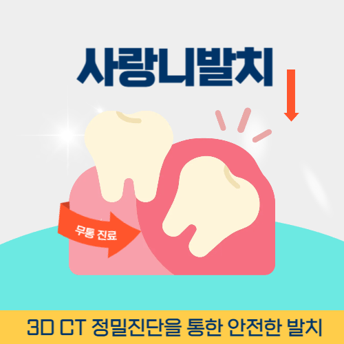 포천치과 포천시 치과 사랑니 발치