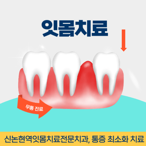 포천치과 포천시 치과 잇몸치료